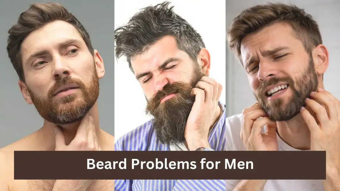 Beard Problems for Men