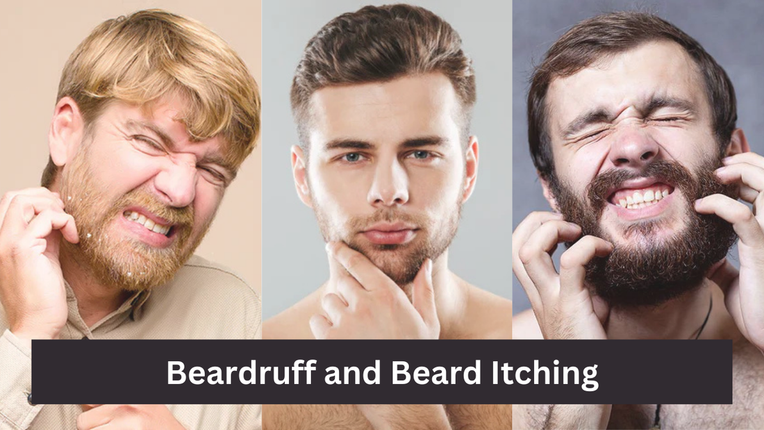 Beardruff and Beard Itching