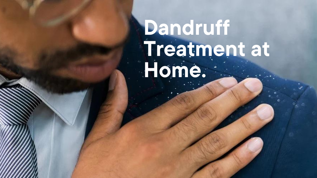 How to Get Rid Off Dandruff at Home in Winters.