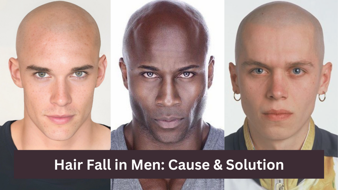 Hair Fall in Men: Cause & Solution