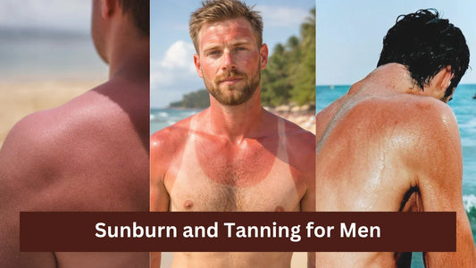 Sunburn and Tanning for Men 