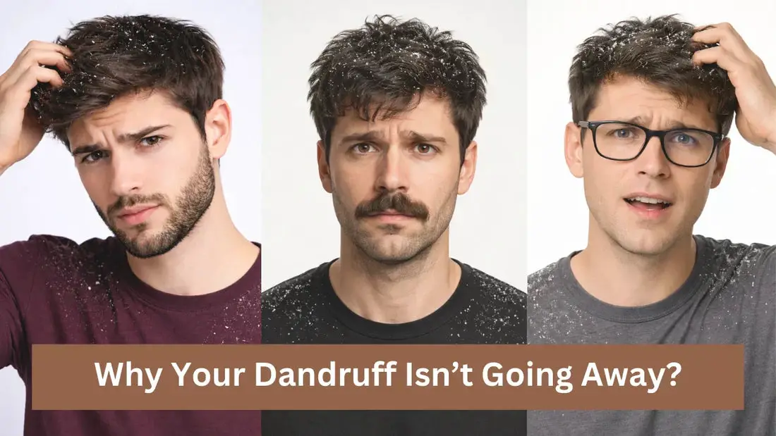 Why Your Dandruff Isn’t Going Away?